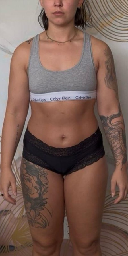 Laisa before