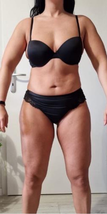 Patricia before
